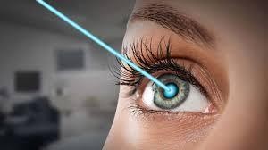 What you probably didn’t know about laser eye surgery